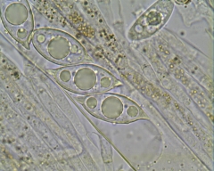 discina perlata spores 35 x 13 UM dont deux appendices de 4 UM chaqu un  .jpg